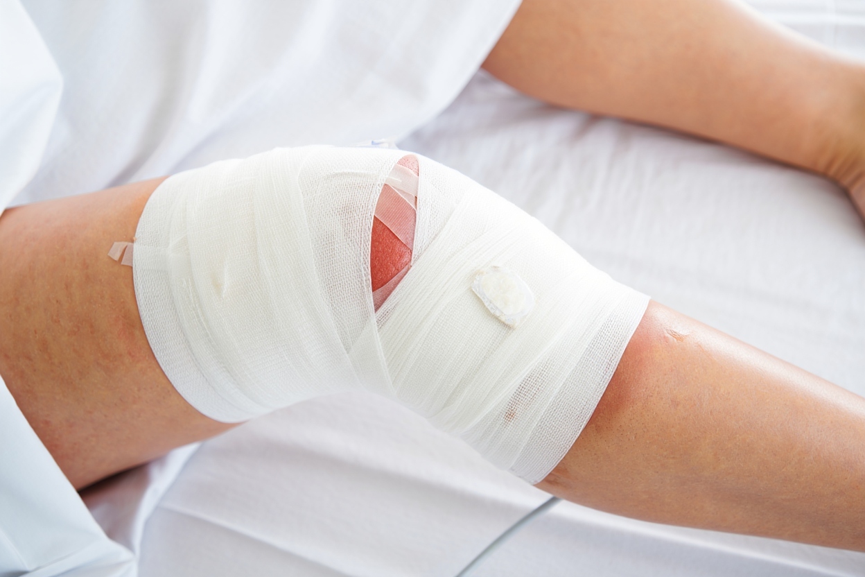 rehabilitacion del ligamento cruzado anterior